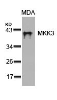 Anti-MEK3 antibody used in Western Blot (WB). GTX50464