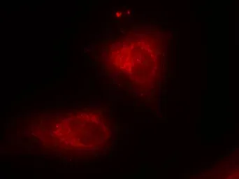 Anti-IKB alpha antibody used in Immunocytochemistry/ Immunofluorescence (ICC/IF). GTX50468
