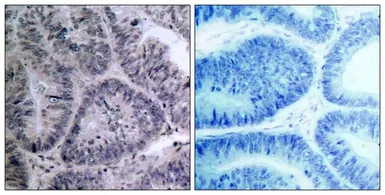 Anti-IKK alpha antibody used in IHC (Paraffin sections) (IHC-P). GTX50469