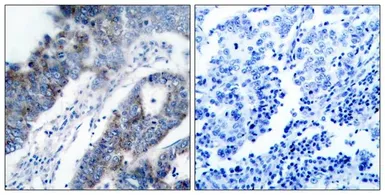 Anti-ASK1 antibody used in IHC (Paraffin sections) (IHC-P). GTX50471