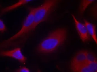 Anti-PKC mu antibody used in Immunocytochemistry/ Immunofluorescence (ICC/IF). GTX50472