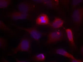 Anti-ASK1 antibody used in Immunocytochemistry/ Immunofluorescence (ICC/IF). GTX50478