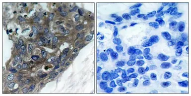 Anti-ASK1 antibody used in IHC (Paraffin sections) (IHC-P). GTX50478