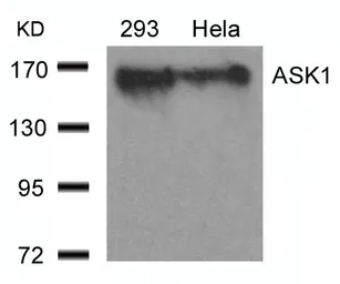 Anti-ASK1 antibody used in Western Blot (WB). GTX50478