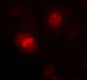 Anti-Histone H3.1 antibody used in Immunocytochemistry/ Immunofluorescence (ICC/IF). GTX50481