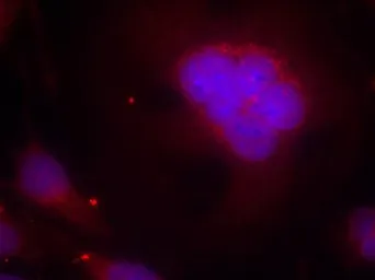 Anti-FOXO1 antibody used in Immunocytochemistry/ Immunofluorescence (ICC/IF). GTX50482