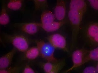 Anti-ATM antibody used in Immunocytochemistry/ Immunofluorescence (ICC/IF). GTX50488