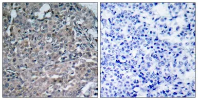Anti-FAK antibody used in IHC (Paraffin sections) (IHC-P). GTX50489