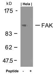 Anti-FAK antibody used in Western Blot (WB). GTX50489