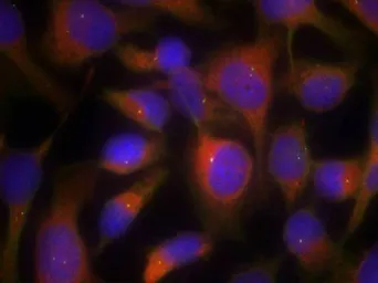 Anti-Myosin Light Chain 2 antibody used in Immunocytochemistry/ Immunofluorescence (ICC/IF). GTX50495