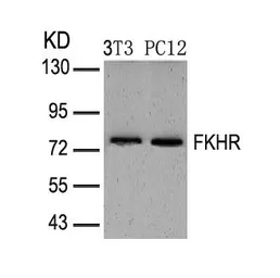 Anti-FOXO1 antibody used in Western Blot (WB). GTX50499
