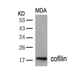 Anti-Cofilin antibody used in Western Blot (WB). GTX50502