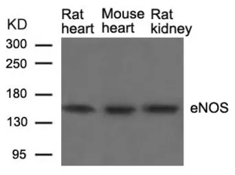 Anti-eNOS antibody used in Western Blot (WB). GTX50505