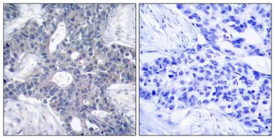 Anti-ZAP70 antibody used in IHC (Paraffin sections) (IHC-P). GTX50508