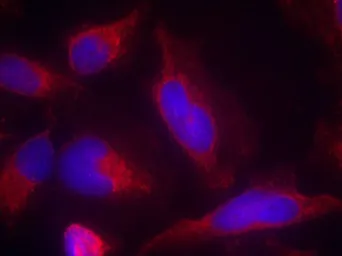 Anti-FLT3 antibody used in Immunocytochemistry/ Immunofluorescence (ICC/IF). GTX50518