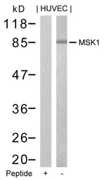 Anti-MSK1 antibody used in Western Blot (WB). GTX50527