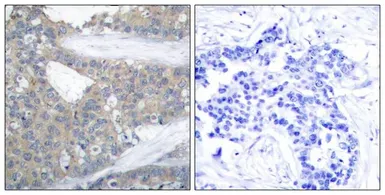 Anti-Paxillin antibody used in IHC (Paraffin sections) (IHC-P). GTX50528