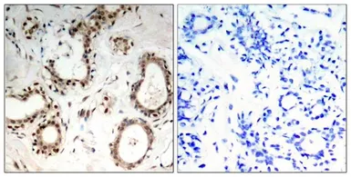 Anti-HSF1 antibody used in IHC (Paraffin sections) (IHC-P). GTX50535