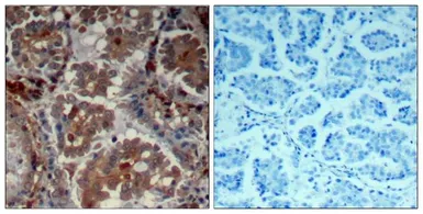 Anti-mTOR antibody used in IHC (Paraffin sections) (IHC-P). GTX50541