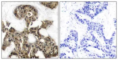 Anti-4E-BP1 antibody used in IHC (Paraffin sections) (IHC-P). GTX50543