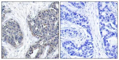 Anti-Stathmin 1 antibody used in IHC (Paraffin sections) (IHC-P). GTX50545