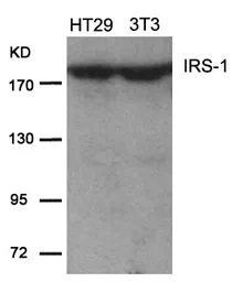 Anti-IRS1 antibody used in Western Blot (WB). GTX50551