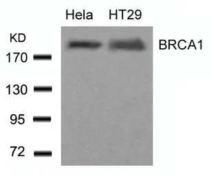 Anti-BRCA1 antibody used in Western Blot (WB). GTX50557