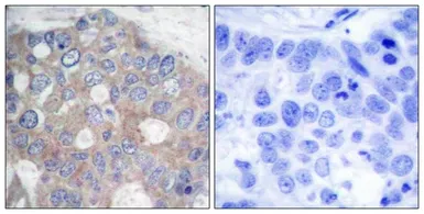Anti-p70 S6K antibody used in IHC (Paraffin sections) (IHC-P). GTX50567