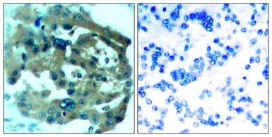 Anti-Merlin antibody used in IHC (Paraffin sections) (IHC-P). GTX50579