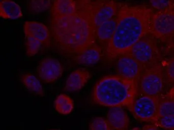 Anti-p70 S6K antibody used in Immunocytochemistry/ Immunofluorescence (ICC/IF). GTX50582