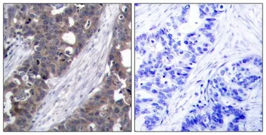 Anti-p70 S6K antibody used in IHC (Paraffin sections) (IHC-P). GTX50582