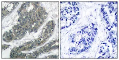 Anti-p62Dok antibody used in IHC (Paraffin sections) (IHC-P). GTX50588