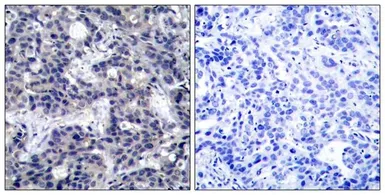 Anti-PKR antibody used in IHC (Paraffin sections) (IHC-P). GTX50591