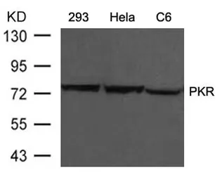 Anti-PKR antibody used in Western Blot (WB). GTX50591