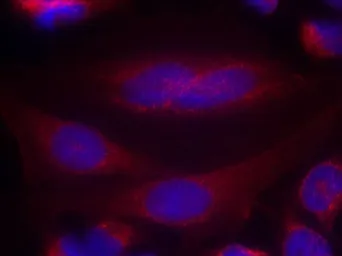 Anti-alpha Synuclein antibody used in Immunocytochemistry/ Immunofluorescence (ICC/IF). GTX50595