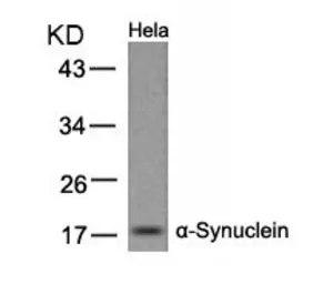 Anti-alpha Synuclein antibody used in Western Blot (WB). GTX50595