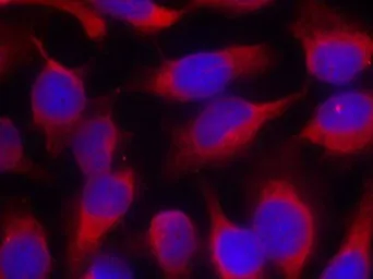 Anti-MARCKS antibody used in Immunocytochemistry/ Immunofluorescence (ICC/IF). GTX50602