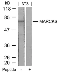 Anti-MARCKS antibody used in Western Blot (WB). GTX50602