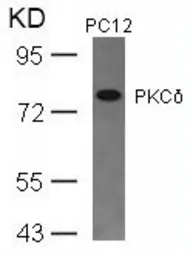 Anti-PKC delta antibody used in Western Blot (WB). GTX50605