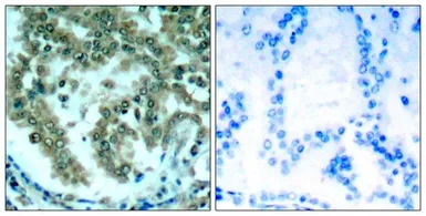 Anti-PKC theta antibody used in IHC (Paraffin sections) (IHC-P). GTX50606