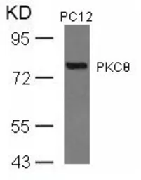 Anti-PKC theta antibody used in Western Blot (WB). GTX50606