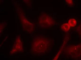 Anti-SHC1 antibody used in Immunocytochemistry/ Immunofluorescence (ICC/IF). GTX50620
