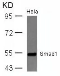 Anti-Smad1 antibody used in Western Blot (WB). GTX50625