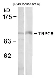 Anti-TRPC6 antibody used in Western Blot (WB). GTX50636