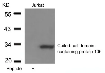 Anti-CCDC106 antibody used in Western Blot (WB). GTX50641