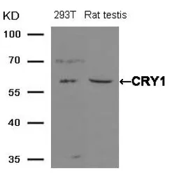 Anti-CRY1 antibody used in Western Blot (WB). GTX50642