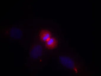 Anti-AKT1 antibody used in Immunocytochemistry/ Immunofluorescence (ICC/IF). GTX50648