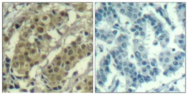 Anti-AKT1 antibody used in IHC (Paraffin sections) (IHC-P). GTX50648