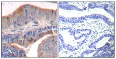 Anti-Stathmin 1 antibody used in IHC (Paraffin sections) (IHC-P). GTX50655