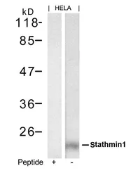 Anti-Stathmin 1 antibody used in Western Blot (WB). GTX50655